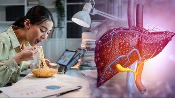 Is a desk job increasing your risk of non-alcoholic fatty liver disease? Is a desk job increasing your risk of non-alcoholic fatty liver disease?