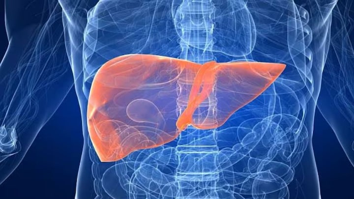 Dr Explains: It’s not just alcohol — your diet might be putting your liver at risk